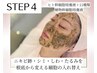 【ニキビ・シミ・たるみ】10種ヒト幹細胞×ハーブ！細胞を入替える本気改善
