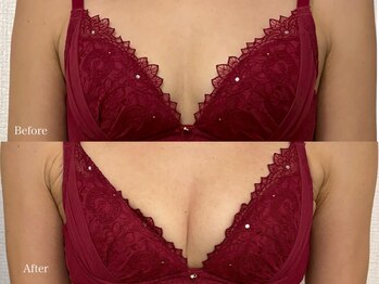 育乳整体&バストアップ専門店 Laurino salon【バストアップ/整体/姿勢改善/産後】/戻りにくいバストアップ整体