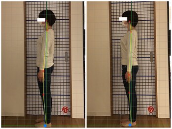 ぶっちょ整骨院 くずは鍼灸院/一回でこの効果◎姿勢改善施術