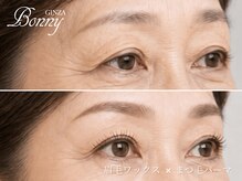 ギンザボニー 銀座本店(GINZA Bonny)の雰囲気（自分史上最高のナチュラル美。眉毛ワックス×まつ毛パーマ。）