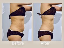 ビオラ(Viola)/◇ Before→After ◇