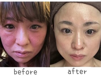 トモズサロン28(Tomos.salon.)/肌トラブル改善！敏感肌にも◎