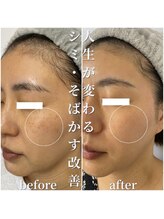 セリー(Celie)/お客様症例