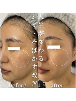 セリー(Celie)/お客様症例