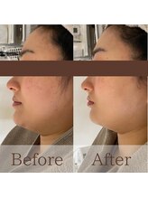 凪眠/小顔リンパフェイシャルの効果34