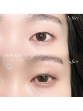 ナナゴー(75)/まつパ / カールデザイン