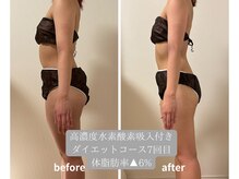 ヨサパーク エミリア(YOSA PARK Emiria)/ダイエットコースのお客様