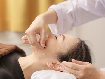 伝統鍼灸一滴庵の写真/【2.3ヶ月で卒業する美容鍼灸】“卒業型”施術で効率的にケア！ほうれい線・たるみ改善は当店にお任せ！