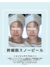 ソワナ(soina)/【神楽坂駅/フェイシャル/毛穴】