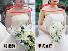 優子さんの美容矯正サロン/鎖骨ライン革命！ブライダル痩身