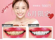 エクシアホワイト SOKA(ecxia white)