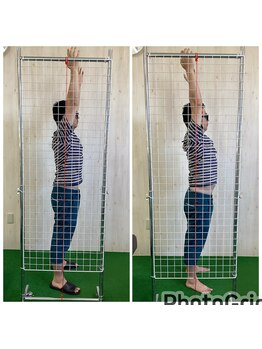 ストレッチヒーロー 鳥取店(STRETCH HERO)/腕挙上