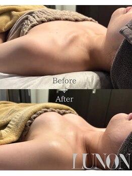 ルノン(Lunon)/背中のお肉をバストに変える★