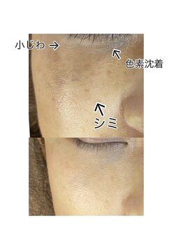 グロウ(glow)/シミ、シワケアと言えばこれ！！