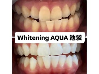 アクア 池袋店(AQUA)/ホワイトニング/池袋/東京/美白