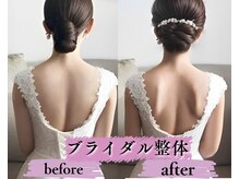 哲 梅田店/ブライダル/肩甲骨/デコルテ