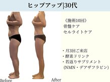 京都フォーエイチ(京都4H)/30代|ヒップアップ♪