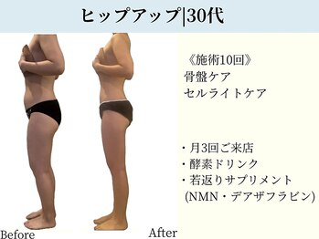 京都フォーエイチ(京都4H)/30代|ヒップアップ♪