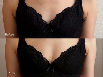 育乳整体&バストアップ専門店 Laurino salon【バストアップ/整体/姿勢改善/産後】/結果出し&満足度No1☆