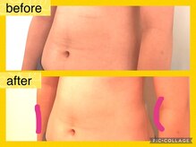 ミモザ(mimosa)/ウェストにくびれが復活。