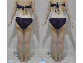 アルマ 芦屋(ALMA)/1回でも◎続ければもっと◎