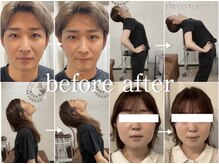 ザ ハイライト 恵比寿の雰囲気（首肩こり、腰痛、食いしばりによるエラの張り、ほうれい線も改善）