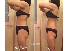 アプローズ(APPLAUSE)/熟練ハンドテクニックを体感