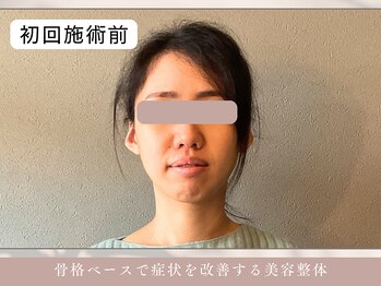 ほぐし屋 かすがい/初回/小顔リフト+美姿勢整体