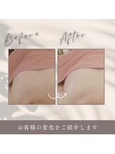 ダノンナ(Da Nonna relaxation house)/コロンとまんまるおっぱいに