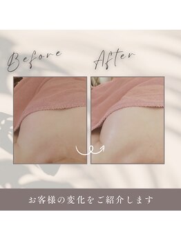 ダノンナ(Da Nonna relaxation house)/コロンとまんまるおっぱいに