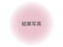 ファニービー 茨木本店/Before→After