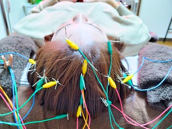 ひふねの写真/凝り固まった頭をほぐして目元&頭の疲労を改善!肩こり・頭痛がお悩みの方おすすめ、自律神経の乱れにも◎