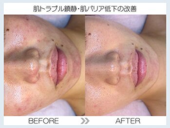 フェアリー(fairy)/