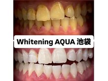 アクア 池袋店(AQUA)/ホワイトニング/池袋/東京/美白