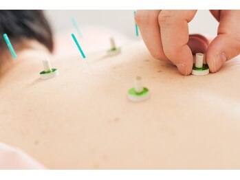 オン 蕨駅西口(ON)の写真/鍼灸で首肩の辛さを取りたい!全身の疲れ・不眠・更年期のだるさも、自律神経を整えてリフレッシュ♪