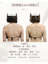 イチカ 仙川店( ichika)/全身の筋膜から整える