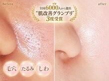プライベートサロン 美月