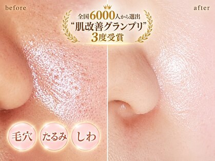 プライベートサロン 美月の写真