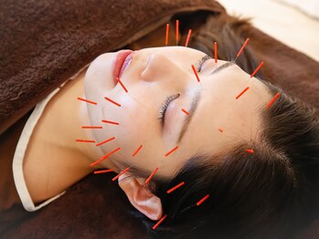 鍼灸院ワタナベコウヘイ(Watanabe Kohei)/まずは美容鍼を行います!