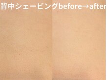 ももとゆでたまご/背中シェービング/花嫁背中艶肌