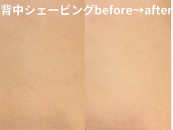 ももとゆでたまご/背中シェービング/花嫁背中艶肌