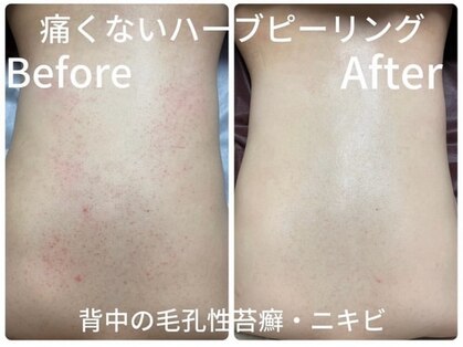 ルアナアイナ 池袋店(Luana Aina)の写真