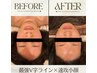 【脱丸顔！】目の疲れ/顔のむくみ改善!小顔リンパ+ドライヘッドスパ付　60分