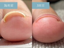エトワル(etoile)の雰囲気（帰るころには痛みや違和感から解放される巻き爪ケア◎）