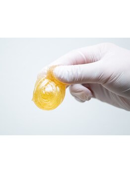 デリケート部分の脱毛/Vライン/VIO