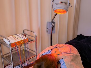 松本整骨院/慢性肩こりも鍼でアプローチ