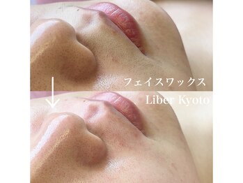 リベルキョウト 京都駅前店(Liber Kyoto)/フェイスワックス脱毛
