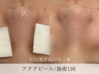 ミューズ バイ エス(MUSE BY S)/