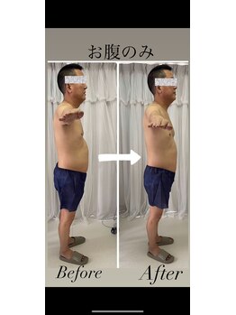 オパール(Opal)/お腹のみ