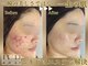 ラヴレボーテ(La Vraie Beaute)の写真